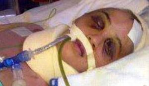 Jyoti-Singh-Pandey-real-name-delhi-bus-rape-victim-Damini-original-image-safdarganj-hospital